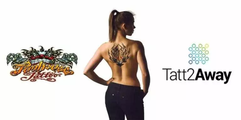 Tattoo Removal Done Differently